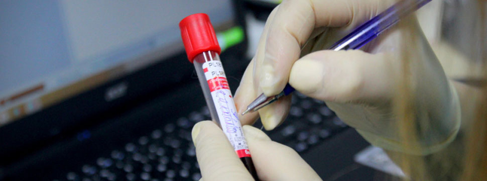 FDA отозвало разрешение на Pepaxto из-за смерти 48% принимавших его пациентов