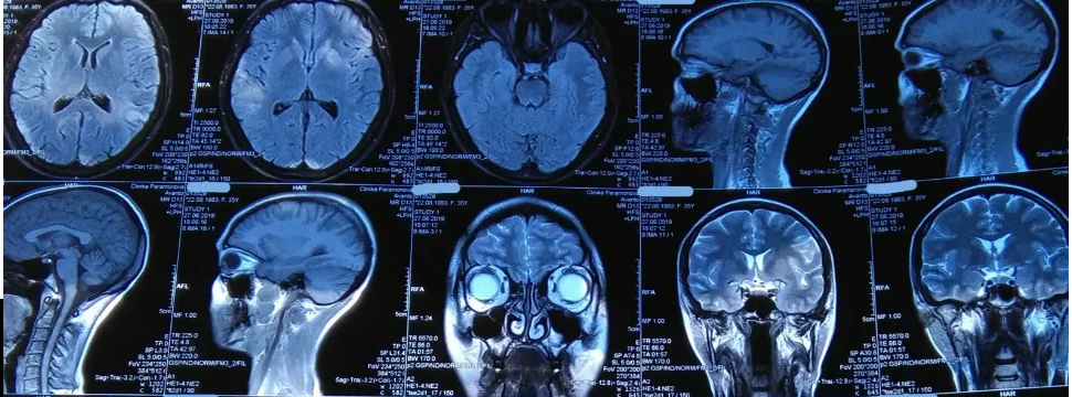 iScience: разработан эффективный способ выращивания хряща головы и шеи человека