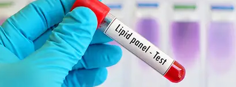 Успехи Eli Lilly в борьбе с холестерином
